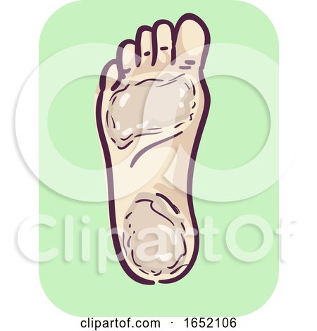 Foot Symptom Thicken Skin Illustration by BNP Design Studio