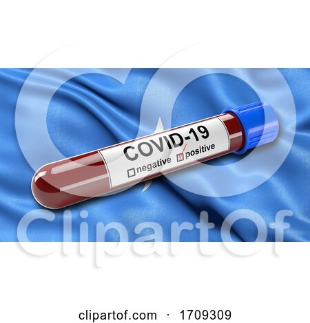 Flag of Somalia Waving in the Wind with a Positive Covid 19 Blood Test Tube by stockillustrations