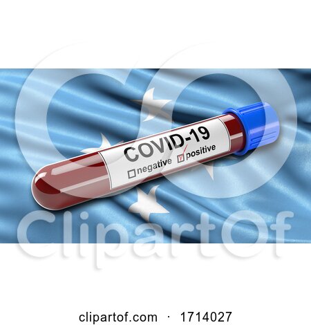 Flag of Micronesia Waving in the Wind with a Positive Covid 19 Blood Test Tube by stockillustrations