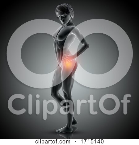 3D Medical Image of Female Holding Her Hip in Pain by KJ Pargeter