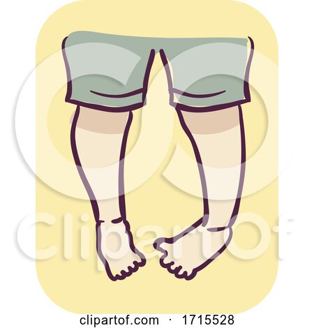 Kid Symptom Twisted Foot Illustration by BNP Design Studio