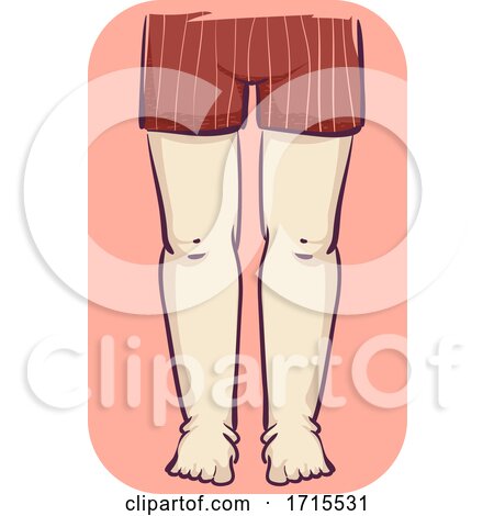 Girl Leg Swelling Illustration by BNP Design Studio