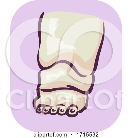 Symptom Feet Enlargement Illustration by BNP Design Studio