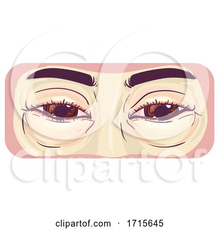 Symptom Swollen Eyes Illustration by BNP Design Studio