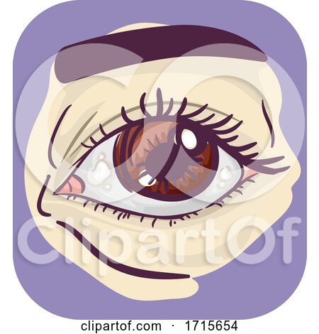 Symptom Eyes Bump Illustration by BNP Design Studio