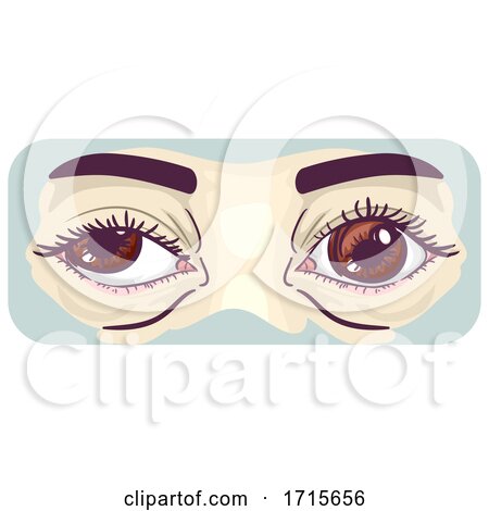 Symptom Lazy Eye Illustration by BNP Design Studio
