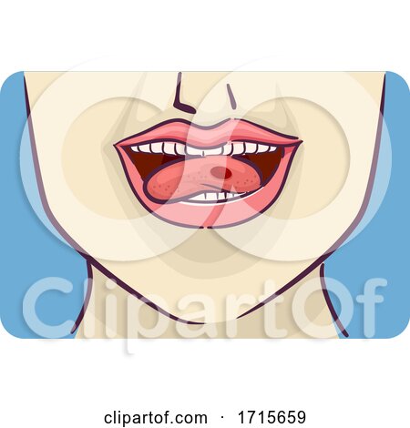 Symptom Red Blood Blister Side Tongue Illustration by BNP Design Studio