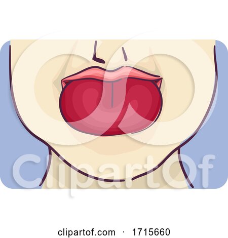 Symptom Swelling Tongue Illustration by BNP Design Studio