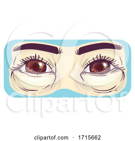 Symptom Puffy Baggy Eyes Illustration by BNP Design Studio