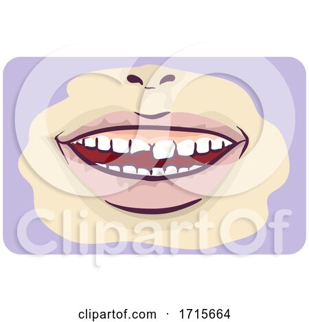 Symptoms Chipped Tooth Illustration by BNP Design Studio