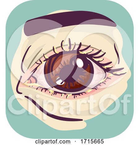 Symptoms Crusty Eye Illustration by BNP Design Studio