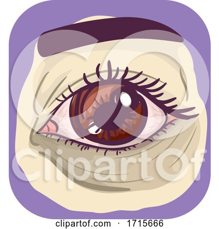 Symptoms Dark Under Eye Circle Illustration by BNP Design Studio