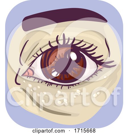 Symptoms Under Eye White Bump Skin Illustration by BNP Design Studio