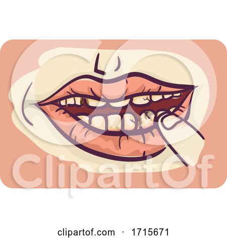 Symptoms Tooth Decay Illustration by BNP Design Studio