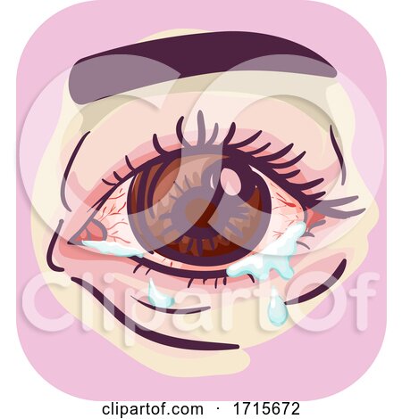 Symptoms Watery Itchy Dry Eyes Illustration by BNP Design Studio