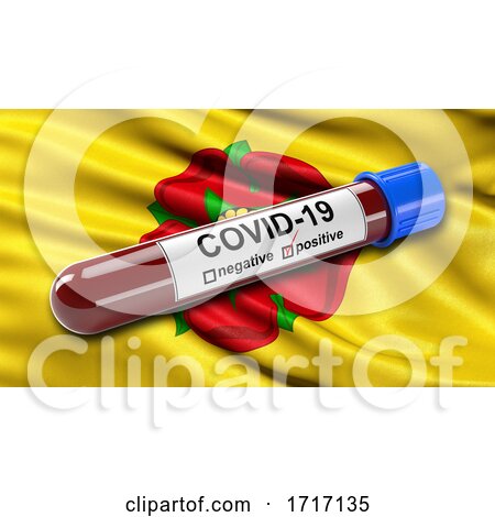Flag of Lancashire Waving in the Wind with a Positive Covid 19 Blood Test Tube by stockillustrations