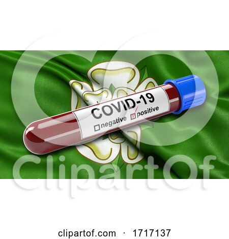 Flag of North Yorkshire Waving in the Wind with a Positive Covid 19 Blood Test Tube by stockillustrations