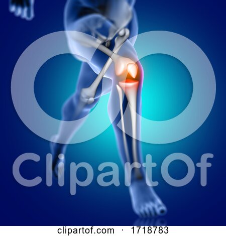 3D Male Medical Figure Running with Knee Bone Highlighted by KJ Pargeter