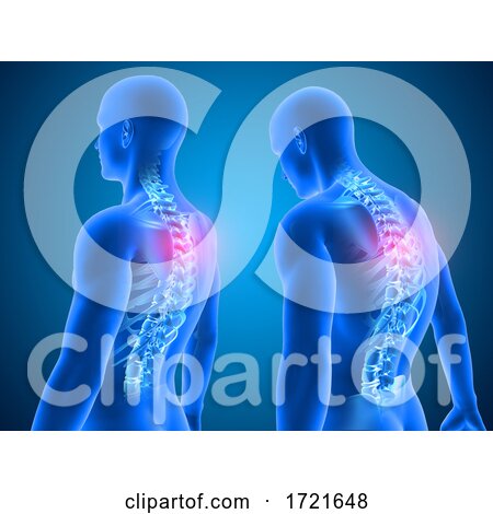 3D Medical Background Showing Good and Poor Posture with Spine Highlighted by KJ Pargeter