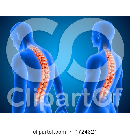 3D Medical Background Showing Correct and Poor Posture with Spine Highlighted by KJ Pargeter