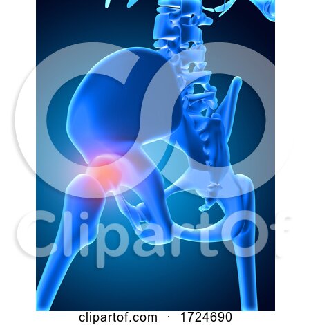 3D Medical Image of Skeleton with Hip Bone Highlighted by KJ Pargeter