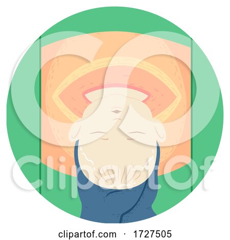 Baby Cesarean Section Surgery Illustration by BNP Design Studio