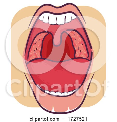 Symptom Mouth Tonsillitis Illustration by BNP Design Studio