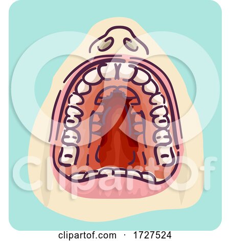 High Arched Palate Crowded Teeth Illustration by BNP Design Studio