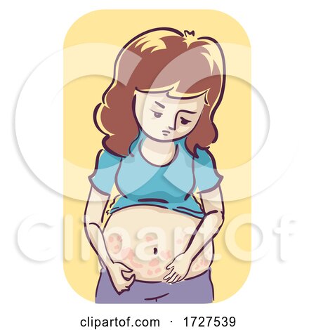 Girl Pregnant Pregnancy Rash Symptom Illustration by BNP Design Studio