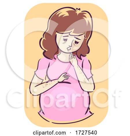 Pregnant Skin Discoloration Symptoms Illustration by BNP Design Studio