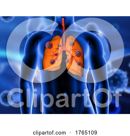 3D Medical Background with Close up of Lungs Being Attacked by Covid 19 Virus Cells by KJ Pargeter