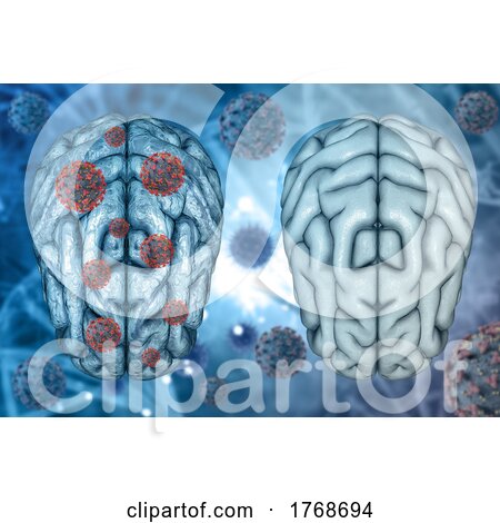 3D Medical Background of Healthy Brain and Diseased Brain with Covid 19 Virus Cells by KJ Pargeter