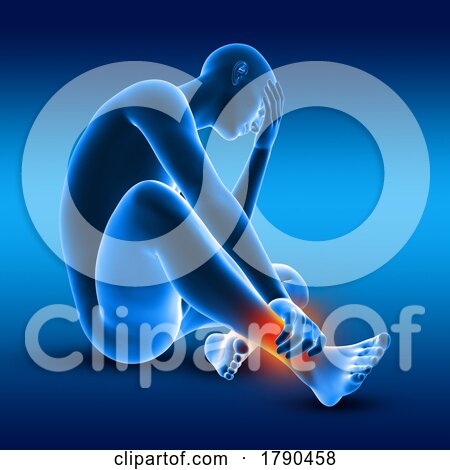 3D Male Medical Figure Holding His Ankle in Pain by KJ Pargeter