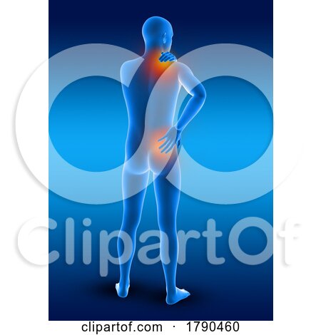 3D Male Medical Figure Holding His Neck and Back in Pain by KJ Pargeter