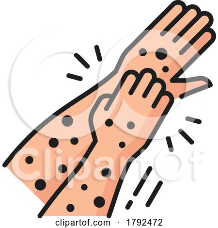 Hand with Allergy Spots by Vector Tradition SM