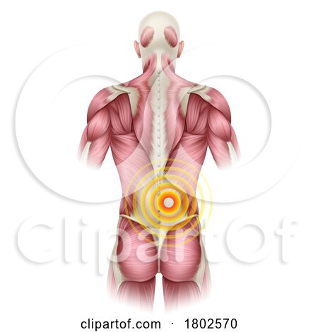 Lower Back Pain Medical Anatomy Illustration by AtStockIllustration