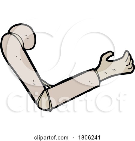 Cartoon Prosthetic Arm by lineartestpilot