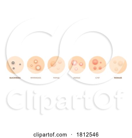 Dermatology Skin Conditions by Vector Tradition SM