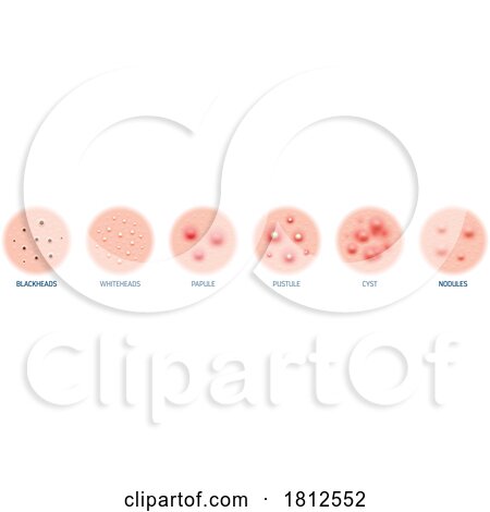 Dermatology Skin Conditions by Vector Tradition SM