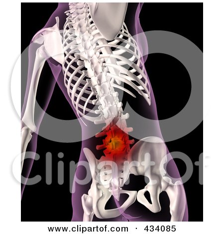 Royalty-Free (RF) Clipart Illustration of an Xray Of A Female Skeleton With Lower Back Pain by KJ Pargeter