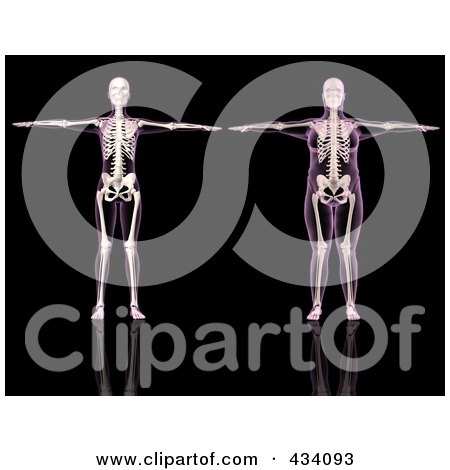 Royalty-Free (RF) Clipart Illustration of a Digital Collage Of Thin And Overweight Female Skeletons by KJ Pargeter