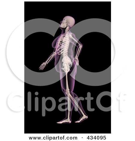 Royalty-Free (RF) Clipart Illustration of an Xray Of An Overweight Female Skeleton Walking With A Bad Back by KJ Pargeter