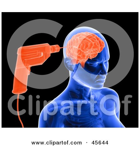 Royalty-free (RF) Clipart Illustration of a Blue Xray Of A Drill Drilling Into A Woman's Brain by Michael Schmeling