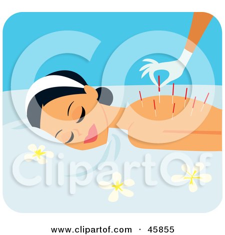 Royalty-free (RF) Clipart Illustration of a Relaxed Woman Getting Acupuncture Needles Inserted In Her Back by Monica
