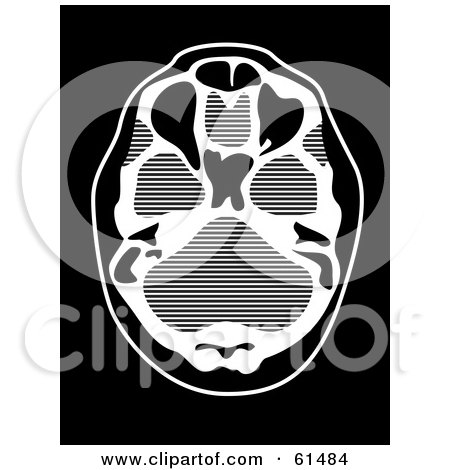 Royalty-free (RF) Clipart Illustration of a Black And White CT Scan by r formidable