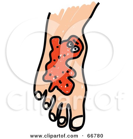 Royalty-Free (RF) Clipart Illustration of a Foot With Orange Germs by Prawny
