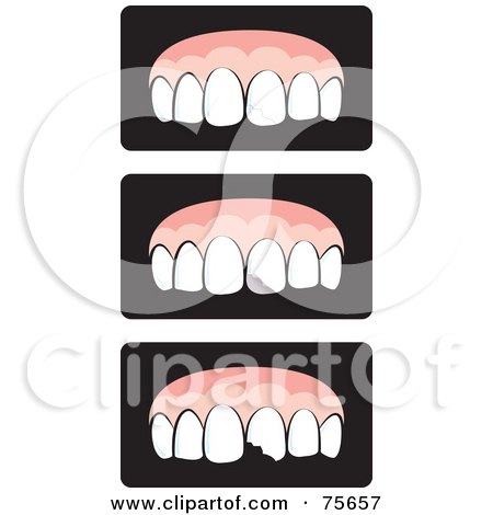 Royalty-Free (RF) Clipart Illustration of a Digital Collage Of Healthy And Decaying Teeth by Lal Perera
