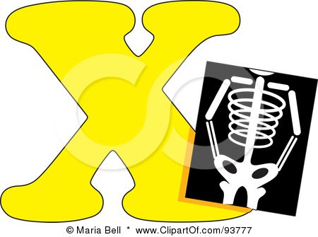 Royalty-Free (RF) Clipart Illustration of a X Is For Xray Learn The Alphabet Scene by Maria Bell