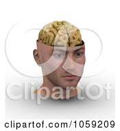 Poster, Art Print Of 3d Male Head With Exposed Brain