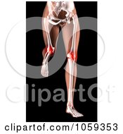Poster, Art Print Of 3d Womans Body Running With Knee Pain Highlighted